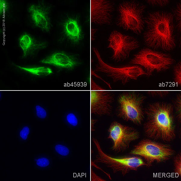 Immunocytochemistry/ Immunofluorescence - Anti-Vimentin antibody - Cytoskeleton Marker (AB45939)