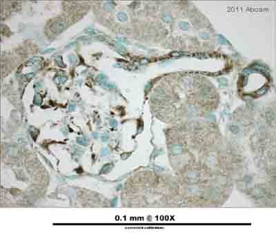 Immunohistochemistry (Formalin/PFA-fixed paraffin-embedded sections) - Anti-Vimentin antibody - Cytoskeleton Marker (ab45939), expandable thumbnail