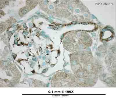 Immunohistochemistry (Formalin/PFA-fixed paraffin-embedded sections) - Anti-Vimentin antibody - Cytoskeleton Marker (AB45939)