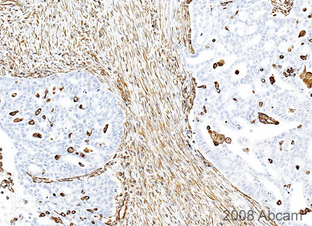 Immunohistochemistry (Formalin/PFA-fixed paraffin-embedded sections) - Anti-Vimentin antibody - Cytoskeleton Marker (ab45939), expandable thumbnail
