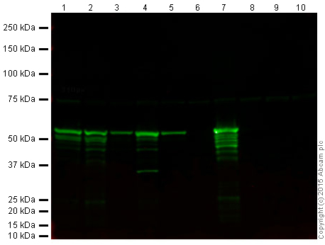 Western blot - Anti-Vimentin antibody - Cytoskeleton Marker (AB45939), expandable thumbnail