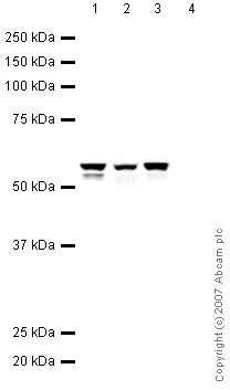 Western blot - Anti-Vimentin antibody - Cytoskeleton Marker (AB45939)