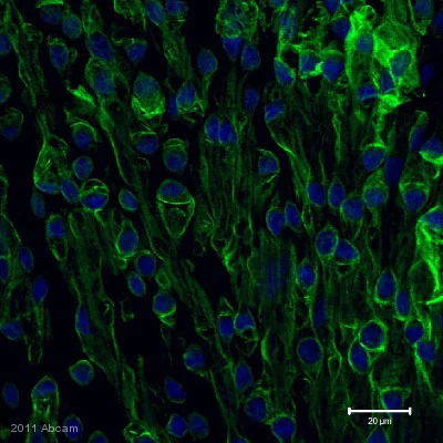 Immunocytochemistry/ Immunofluorescence - Anti-Vimentin antibody [EPR3776] - BSA and Azide free (AB193555)