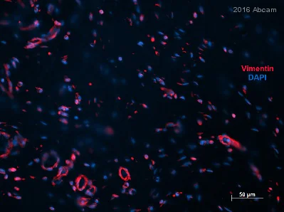 Immunohistochemistry (Formalin/PFA-fixed paraffin-embedded sections) - Anti-Vimentin antibody [EPR3776] - BSA and Azide free (AB193555)