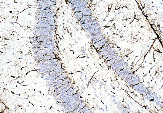 Immunohistochemistry (Formalin/PFA-fixed paraffin-embedded sections) - Anti-Vimentin antibody [EPR3776] - BSA and Azide free (AB193555)