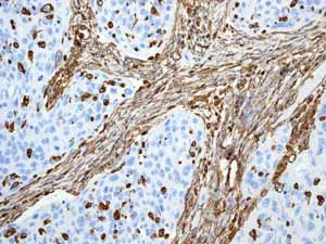 Immunohistochemistry (Formalin/PFA-fixed paraffin-embedded sections) - Anti-Vimentin antibody [EPR3776] - BSA and Azide free (AB193555)