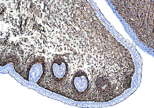 Immunohistochemistry (Formalin/PFA-fixed paraffin-embedded sections) - Anti-Vimentin antibody [EPR3776] - BSA and Azide free (AB193555)