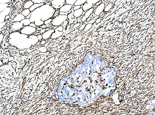 Immunohistochemistry (Formalin/PFA-fixed paraffin-embedded sections) - Anti-Vimentin antibody [EPR3776] - BSA and Azide free (AB193555)