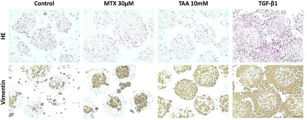 Immunohistochemistry (Formalin/PFA-fixed paraffin-embedded sections) - Anti-Vimentin antibody [EPR3776] - BSA and Azide free (AB193555)