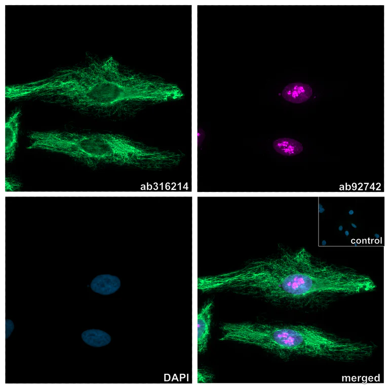 Immunocytochemistry/ Immunofluorescence - Anti-Vimentin antibody [EPR3776] - Chicken IgY (Chimeric) (AB316214)