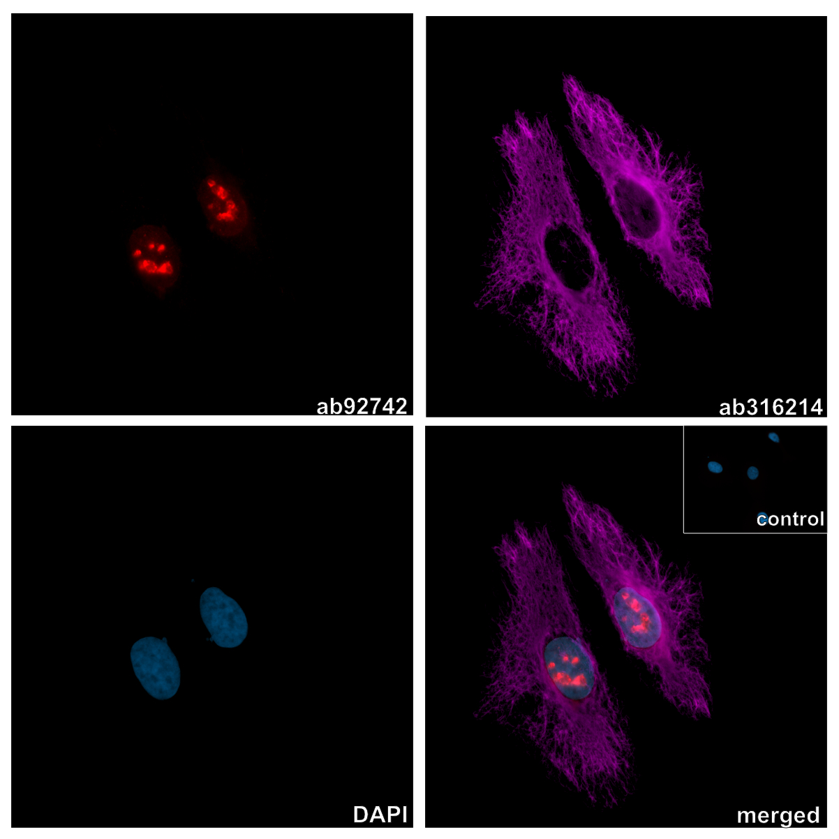 vimentin-antibody-epr3776-