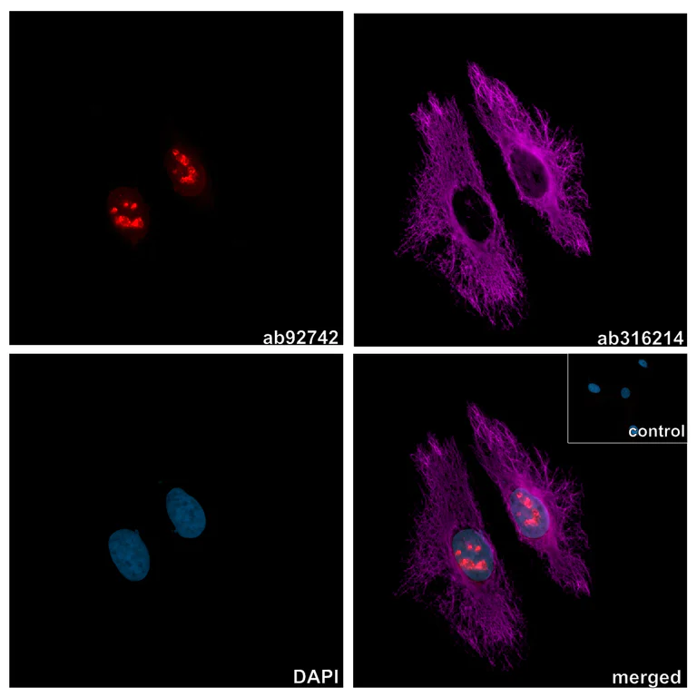 Immunocytochemistry/ Immunofluorescence - Anti-Vimentin antibody [EPR3776] - Chicken IgY (Chimeric) (AB316214)