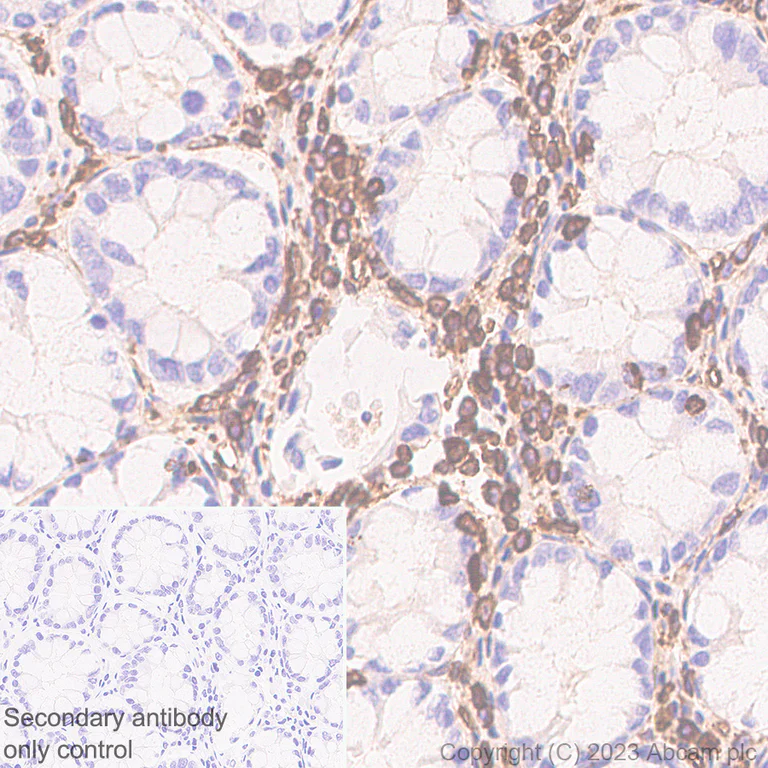 Immunohistochemistry (Formalin/PFA-fixed paraffin-embedded sections) - Anti-Vimentin antibody [EPR3776] - Chicken IgY (Chimeric) (AB316214)