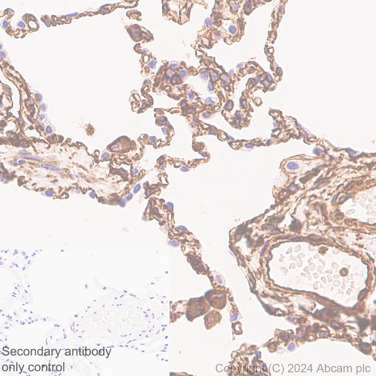 Immunohistochemistry (Formalin/PFA-fixed paraffin-embedded sections) - Anti-Vimentin antibody [EPR3776] - Chicken IgY (Chimeric) (AB316214)
