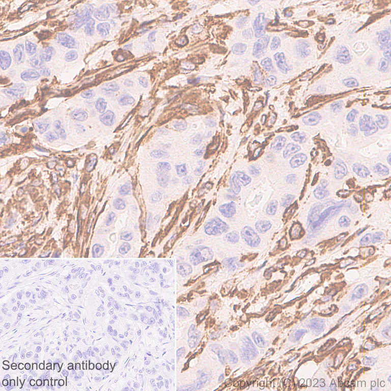 Immunohistochemistry (Formalin/PFA-fixed paraffin-embedded sections) - Anti-Vimentin antibody [EPR3776] - Chicken IgY (Chimeric) (AB316214)