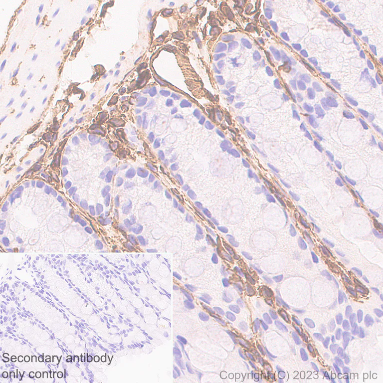 Immunohistochemistry (Formalin/PFA-fixed paraffin-embedded sections) - Anti-Vimentin antibody [EPR3776] - Chicken IgY (Chimeric) (AB316214)