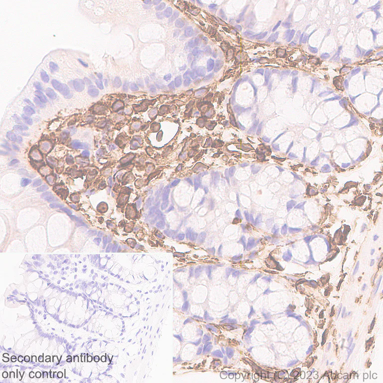 Immunohistochemistry (Formalin/PFA-fixed paraffin-embedded sections) - Anti-Vimentin antibody [EPR3776] - Chicken IgY (Chimeric) (AB316214)