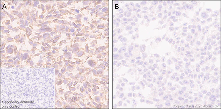 Immunohistochemistry (Formalin/PFA-fixed paraffin-embedded sections) - Anti-Vimentin antibody [EPR3776] - Chicken IgY (Chimeric) (AB316214)