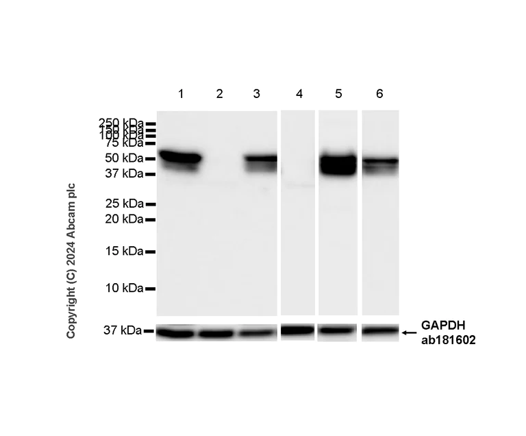 Western blot - Anti-Vimentin antibody [EPR3776] - Chicken IgY (Chimeric) (AB316214)
