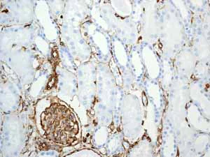 Immunohistochemistry (Formalin/PFA-fixed paraffin-embedded sections) - Anti-Vimentin antibody [EPR3776] - Cytoskeleton Marker (AB92547)
