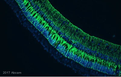 Immunohistochemistry (Formalin/PFA-fixed paraffin-embedded sections) - Anti-Vimentin antibody [EPR3776] - Cytoskeleton Marker (AB92547)