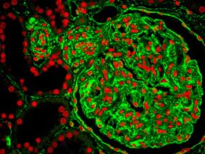 Immunohistochemistry (Formalin/PFA-fixed paraffin-embedded sections) - Anti-Vimentin antibody [EPR3776] - Cytoskeleton Marker (AB92547)