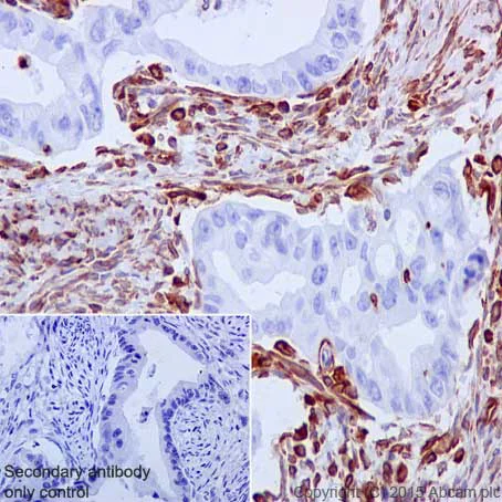 Immunohistochemistry (Formalin/PFA-fixed paraffin-embedded sections) - Anti-Vimentin antibody [EPR3776] - Cytoskeleton Marker (AB92547)