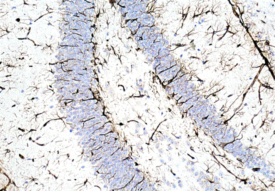 Immunohistochemistry (Formalin/PFA-fixed paraffin-embedded sections) - Anti-Vimentin antibody [EPR3776] - Cytoskeleton Marker (AB92547)