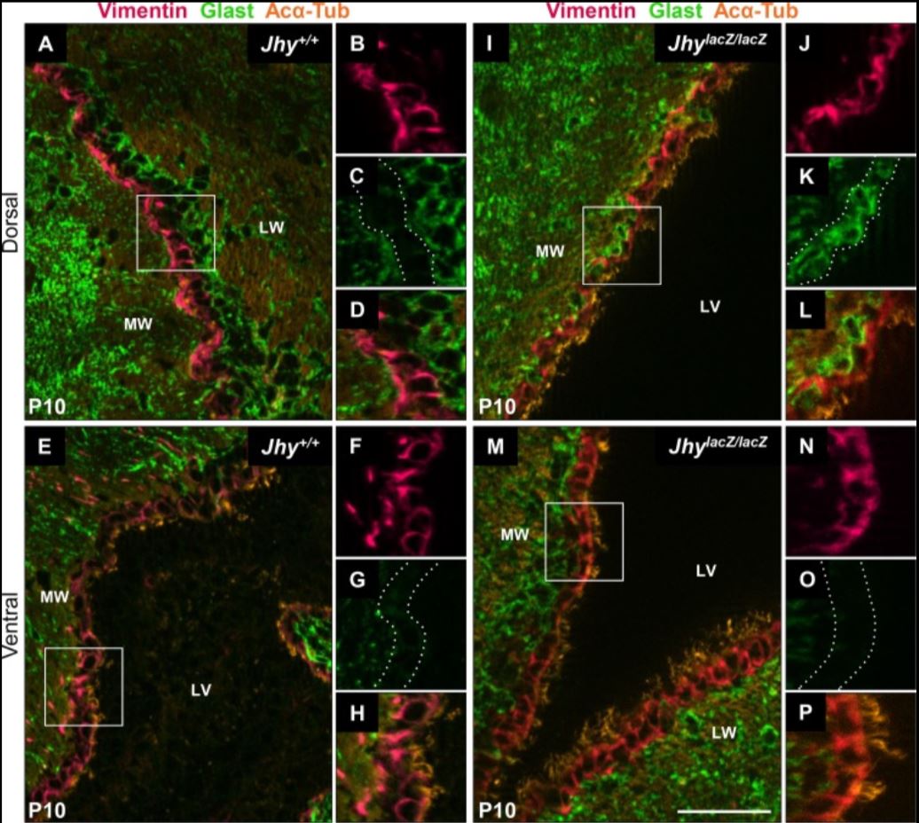 Immunohistochemistry (Formalin/PFA-fixed paraffin-embedded sections) - Anti-Vimentin antibody [EPR3776] - Cytoskeleton Marker (ab92547), expandable thumbnail