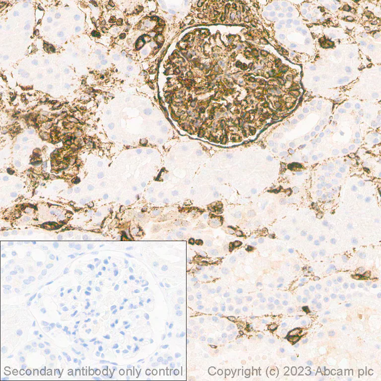 Immunohistochemistry (Formalin/PFA-fixed paraffin-embedded sections) - Anti-Vimentin antibody [EPR3776] - Cytoskeleton Marker (AB92547)