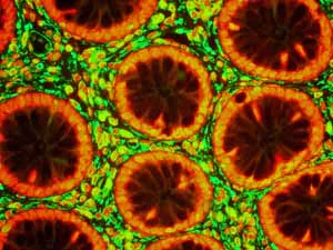 Immunohistochemistry (Formalin/PFA-fixed paraffin-embedded sections) - Anti-Vimentin antibody [EPR3776] - Cytoskeleton Marker (AB92547)