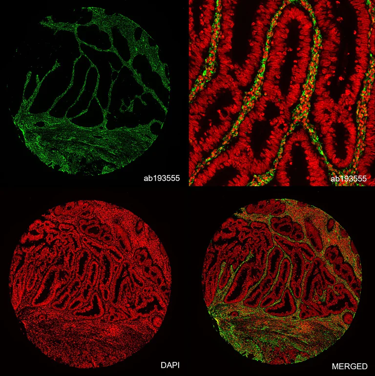 Multiplex immunohistochemistry - Anti-Vimentin antibody [EPR3776] - Cytoskeleton Marker (AB92547)