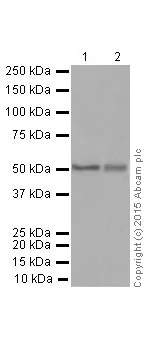 Western blot - Anti-Vimentin antibody [EPR3776] - Cytoskeleton Marker (AB92547)