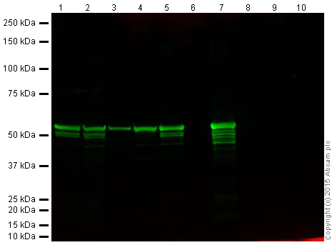 Western blot - Anti-Vimentin antibody [EPR3776] - Cytoskeleton Marker (AB92547)