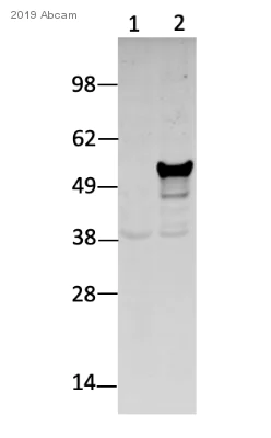 Western blot - Anti-Vimentin antibody [EPR3776] - Cytoskeleton Marker (AB92547)
