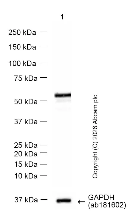 Western blot - Anti-Vimentin antibody [EPR3776] - Cytoskeleton Marker (AB92547)