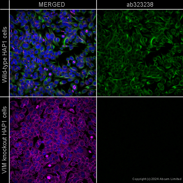Immunocytochemistry/ Immunofluorescence - Anti-Vimentin antibody [EPR3776] - Cytoskeleton Marker – Chicken IgY (Chimeric) (AB323238), expandable thumbnail