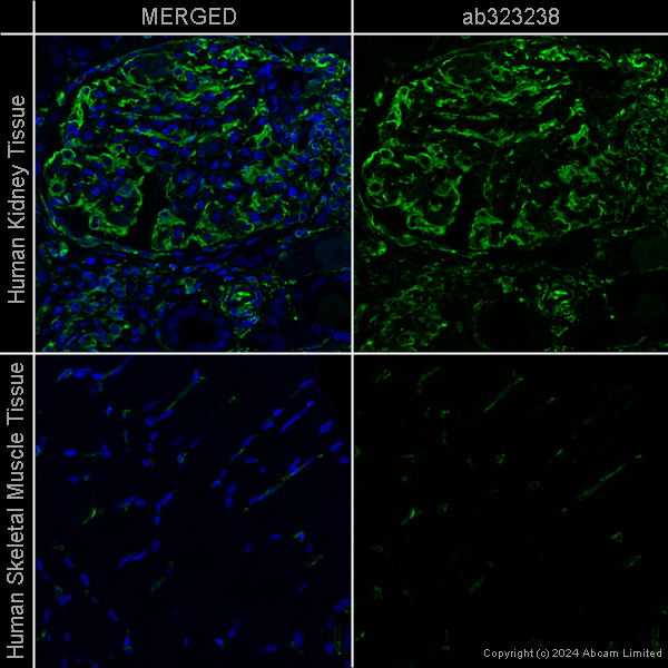 Immunohistochemistry (Formalin/PFA-fixed paraffin-embedded sections) - Anti-Vimentin antibody [EPR3776] - Cytoskeleton Marker – Chicken IgY (Chimeric) (AB323238), expandable thumbnail
