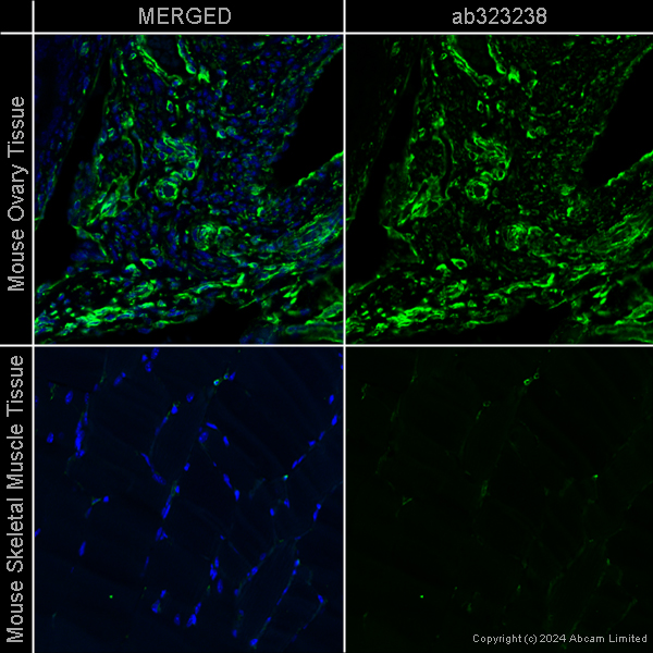 Immunohistochemistry (Formalin/PFA-fixed paraffin-embedded sections) - Anti-Vimentin antibody [EPR3776] - Cytoskeleton Marker – Chicken IgY (Chimeric) (AB323238), expandable thumbnail