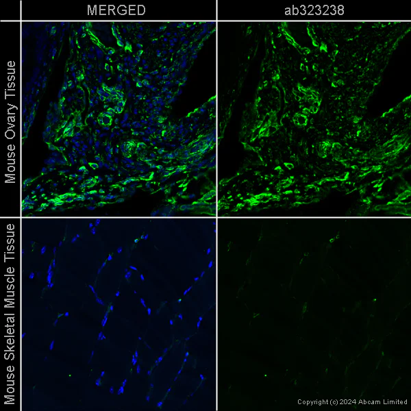 Immunohistochemistry (Formalin/PFA-fixed paraffin-embedded sections) - Anti-Vimentin antibody [EPR3776] - Cytoskeleton Marker – Chicken IgY (Chimeric) (AB323238)