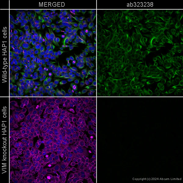 Immunocytochemistry/ Immunofluorescence - Anti-Vimentin antibody [EPR3776] - Cytoskeleton Marker – Chicken IgY (Chimeric) – BSA and Azide Free (AB323247)
