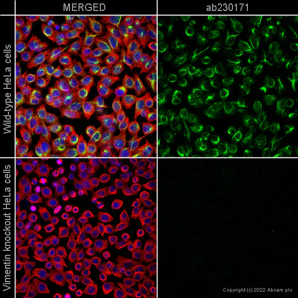 Immunocytochemistry/ Immunofluorescence - Anti-Vimentin antibody [LN-6] (AB230171)