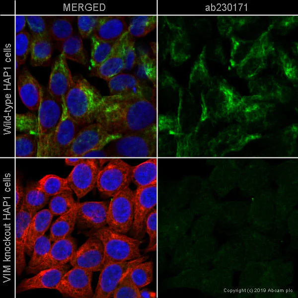 Immunocytochemistry/ Immunofluorescence - Anti-Vimentin antibody [LN-6] (AB230171)