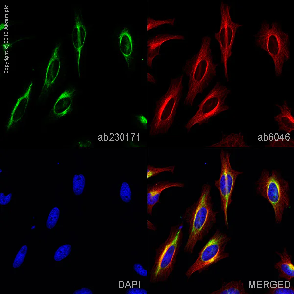 Immunocytochemistry/ Immunofluorescence - Anti-Vimentin antibody [LN-6] (AB230171)
