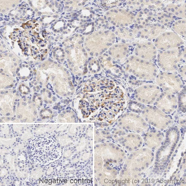 Immunohistochemistry (Formalin/PFA-fixed paraffin-embedded sections) - Anti-Vimentin antibody [LN-6] (AB230171)