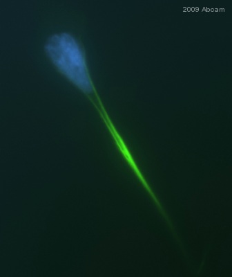 Immunocytochemistry/ Immunofluorescence - Anti-Vimentin antibody [RV202] - Cytoskeleton Marker (ab8978), expandable thumbnail