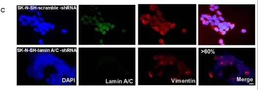 Immunocytochemistry/ Immunofluorescence - Anti-Vimentin antibody [RV202] - Cytoskeleton Marker (AB8978)