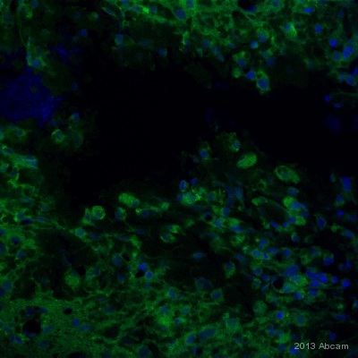 Immunocytochemistry/ Immunofluorescence - Anti-Vimentin antibody [RV202] - Cytoskeleton Marker (ab8978), expandable thumbnail