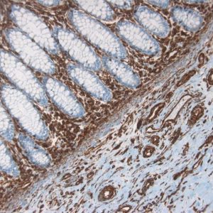 Immunohistochemistry (Formalin/PFA-fixed paraffin-embedded sections) - Anti-Vimentin antibody [RV202] - Cytoskeleton Marker (ab8978), expandable thumbnail
