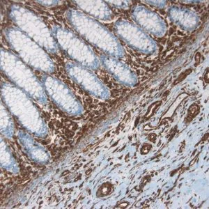 Immunohistochemistry (Formalin/PFA-fixed paraffin-embedded sections) - Anti-Vimentin antibody [RV202] - Cytoskeleton Marker (AB8978)